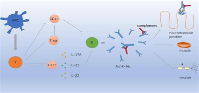 Clinical features of myasthenia gravis with neurological and systemic autoimmune diseases